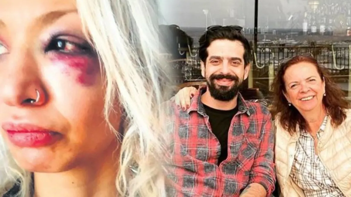 Gitarist Can Tunaboylu’nun şiddet uyguladığı Aybike Çelik GÜNAYDIN’a konuştu “Aydın sanatçı değil empati yoksunu bir kadın”